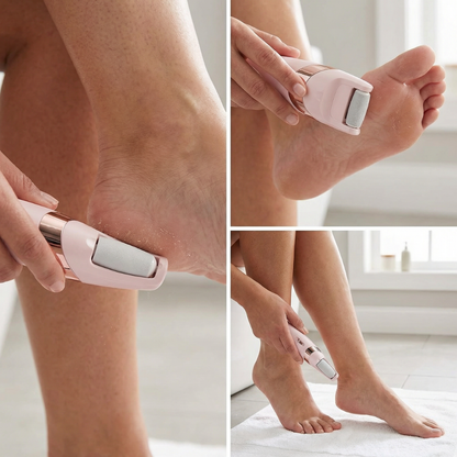 SoftStep Electric Callus Remover